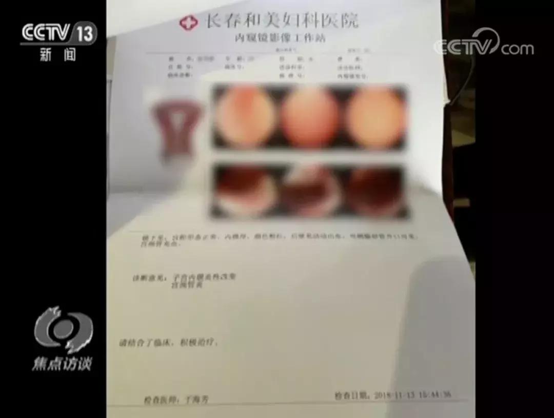 工程机械快换辅具 第85页